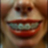 A close-up of vampire braces showcasing their unique design and aesthetic appeal